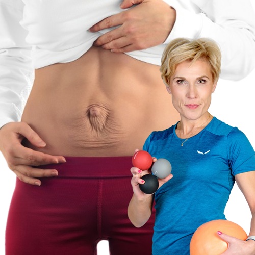 Magdalena Rusiecka-Serwatka_Rozejście mięśnia prostego brzucha (DRA)